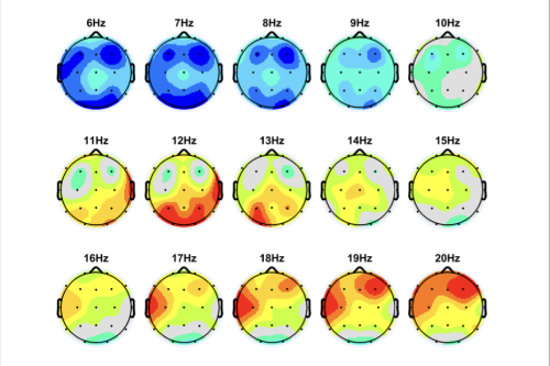 neurofeedback therapy denver
