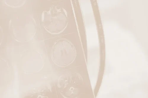 A blurred image shows a set of MRI brain scans partially visible on a light background. The dark film contains several circular scan images of the brain from various angles. The details are indistinct due to the blurriness.